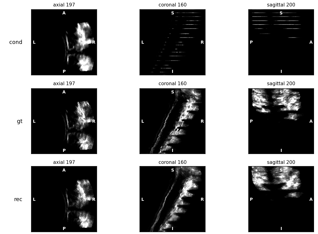 Axial, coronal, and sagittal comparisons between sparse input, ground truth, and reconstructed spine ultrasound